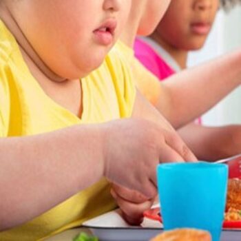 Childhood Obesity, Understanding Its Realities
