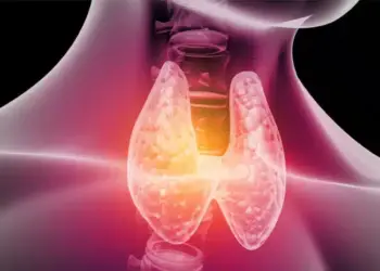 Thyroid Gland, Diet for Thyroid Patients, Mental fogginess