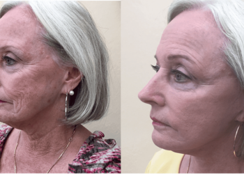 Aging Research Breakthrough, Discover Changes How We Age